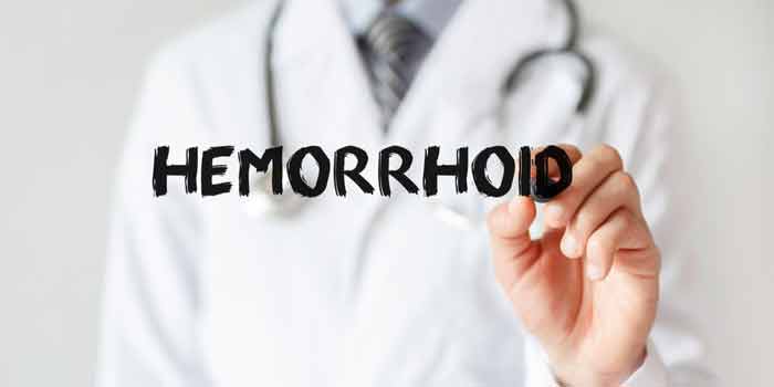 Hemorrhoids