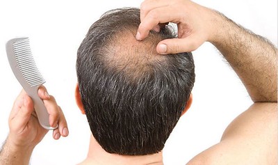 How to get rid of hair loss