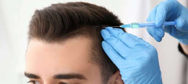 hair loss treatment