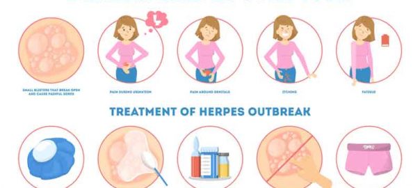Genital Herpes Symptoms, Causes and Treatment of HSV-2
