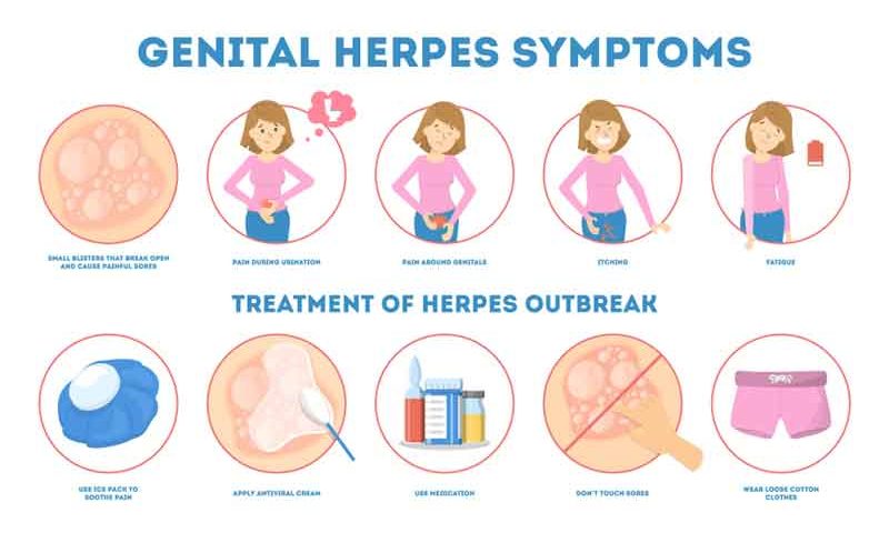 Genital Herpes Symptoms, Causes and Treatment of HSV-2