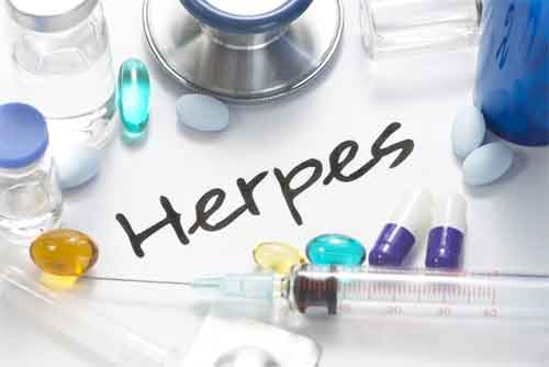 Transmission of Genital Herpes