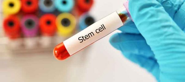 Stem Cell Transplant May Provide Cure for AIDS